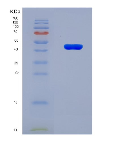 SDS-PAGE analysis of Mouse Itgal (Integrin Alpha-L) - Recombinant Protein, showing >90% purity under 15% SDS-PAGE (Reduced)