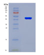 SDS-PAGE analysis of Mouse Itgal (Integrin Alpha-L) - Recombinant Protein, showing >90% purity under 15% SDS-PAGE (Reduced)