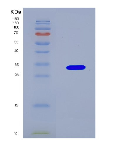 SDS-PAGE analysis of Human NAA10 (N-Alpha-Acetyltransferase 10) - Recombinant Protein, showing >90% purity under 15% SDS-PAGE (Reduced)
