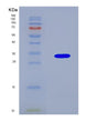 SDS-PAGE analysis of Human NAA10 (N-Alpha-Acetyltransferase 10) - Recombinant Protein, showing >90% purity under 15% SDS-PAGE (Reduced)