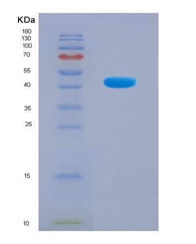 SDS-PAGE analysis of Human IGF2BP3 (Insulin-Like Growth Factor 2 Mrna-Binding Protein 3) - Recombinant Protein, showing >90% purity under 15% SDS-PAGE (Reduced)