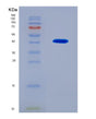 SDS-PAGE analysis of Human ASNS (Asparagine Synthetase [Glutamine-Hydrolyzing]) - Recombinant Protein, showing >90% purity under 15% SDS-PAGE (Reduced)