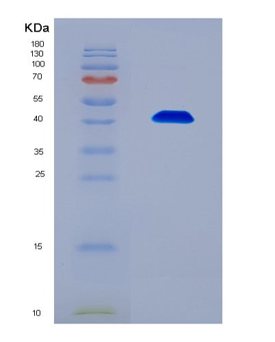 SDS-PAGE analysis of Human DEFA1 (Neutrophil Defensin 1) - Recombinant Protein, showing >90% purity under 15% SDS-PAGE (Reduced)