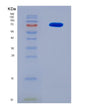 SDS-PAGE analysis of Human PKM (Pyruvate Kinase Pkm) - Recombinant Protein, showing >90% purity under 15% SDS-PAGE (Reduced)