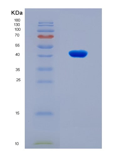 SDS-PAGE analysis of Human LRPAP1 (Alpha-2-Macroglobulin Receptor-Associated Protein) - Recombinant Protein, showing >90% purity under 15% SDS-PAGE (Reduced)