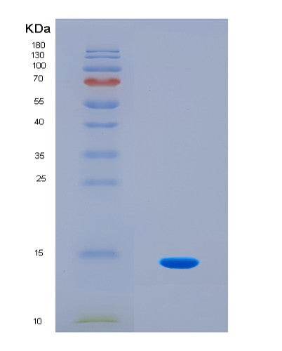 SDS-PAGE analysis of Human DVL2 (Segment Polarity Protein Dishevelled Homolog Dvl-2) - Recombinant Protein, showing >90% purity under 15% SDS-PAGE (Reduced)
