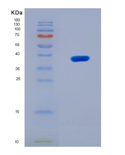 SDS-PAGE analysis of Human MT2A (Metallothionein-2) - Recombinant Protein, showing >90% purity under 15% SDS-PAGE (Reduced)