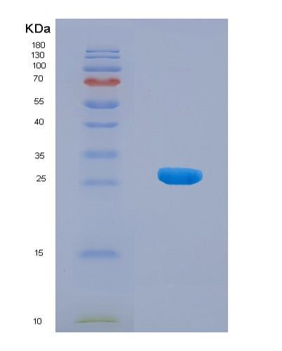 SDS-PAGE analysis of Human F12 (Coagulation Factor Xii) - Recombinant Protein, showing >90% purity under 15% SDS-PAGE (Reduced)
