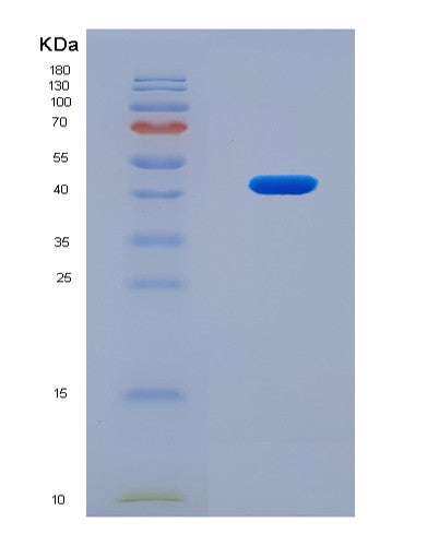 SDS-PAGE analysis of Human MMP9 (Matrix Metalloproteinase-9) - Recombinant Protein, showing >90% purity under 15% SDS-PAGE (Reduced)