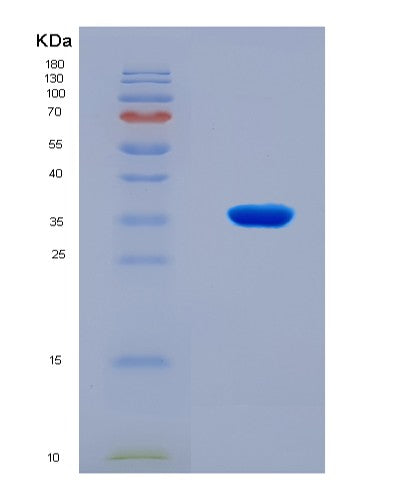 SDS-PAGE analysis of Human PRKDC (Dna-Dependent Protein Kinase Catalytic Subunit) - Recombinant Protein, showing >90% purity under 15% SDS-PAGE (Reduced)
