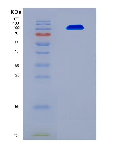 SDS-PAGE analysis of Human UBA1 (Ubiquitin-Like Modifier-Activating Enzyme 1) - Recombinant Protein, showing >90% purity under 15% SDS-PAGE (Reduced)