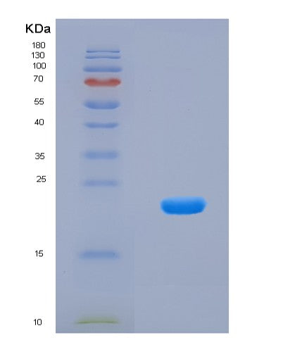 SDS-PAGE analysis of Human SBSN (Suprabasin) - Recombinant Protein, showing >90% purity under 15% SDS-PAGE (Reduced)