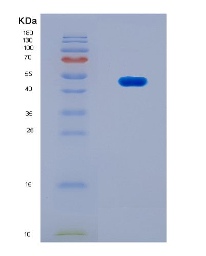 SDS-PAGE analysis of Human ACTA2 (Actin, Aortic Smooth Muscle) - Recombinant Protein, showing >90% purity under 15% SDS-PAGE (Reduced)