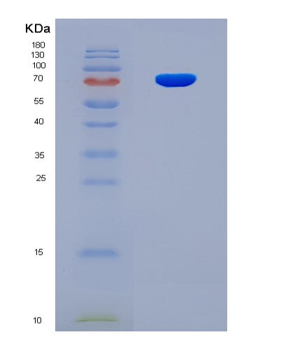 SDS-PAGE analysis of Human NCOA4 (Nuclear Receptor Coactivator 4) - Recombinant Protein, showing >90% purity under 15% SDS-PAGE (Reduced)