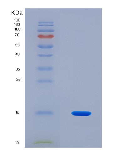 SDS-PAGE analysis of Human FGFR1 (Fibroblast Growth Factor Receptor 1) - Recombinant Protein, showing >90% purity under 15% SDS-PAGE (Reduced)