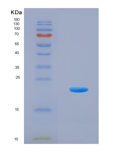 SDS-PAGE analysis of Mouse Il9 (Interleukin-9) - Recombinant Protein, showing >90% purity under 15% SDS-PAGE (Reduced)