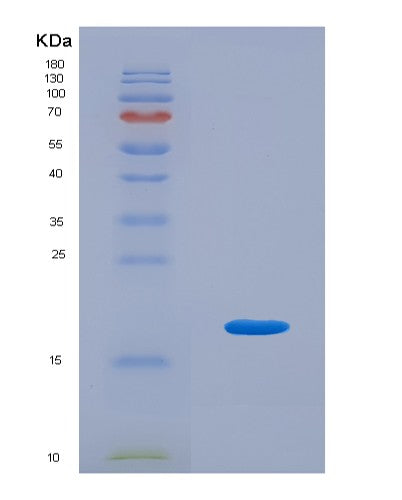 SDS-PAGE analysis of Human IL9 (Interleukin-9) - Recombinant Protein, showing >90% purity under 15% SDS-PAGE (Reduced)