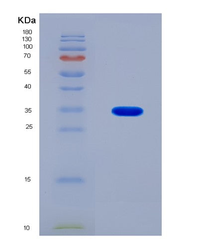 SDS-PAGE analysis of Human RAF1 (Raf Proto-Oncogene Serine/Threonine-Protein Kinase) - Recombinant Protein, showing >90% purity under 15% SDS-PAGE (Reduced)