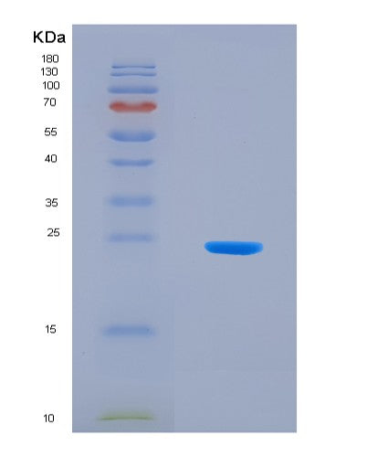 SDS-PAGE analysis of Human SHBG (Sex Hormone-Binding Globulin) - Recombinant Protein, showing >90% purity under 15% SDS-PAGE (Reduced)