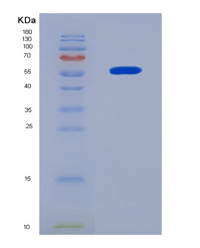 SDS-PAGE analysis of Human CRBN (Protein Cereblon) - Recombinant Protein, showing >90% purity under 15% SDS-PAGE (Reduced)