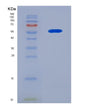 SDS-PAGE analysis of Human CRBN (Protein Cereblon) - Recombinant Protein, showing >90% purity under 15% SDS-PAGE (Reduced)