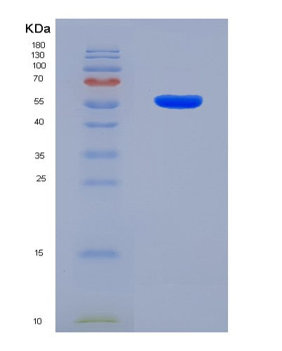 SDS-PAGE analysis of Human CRBN (Protein Cereblon) - Recombinant Protein, showing >90% purity under 15% SDS-PAGE (Reduced)
