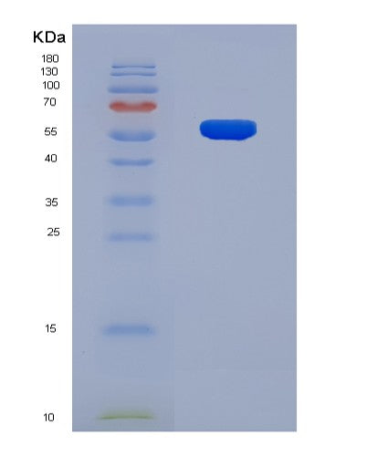 SDS-PAGE analysis of Human CRBN (Protein Cereblon) - Recombinant Protein, showing >90% purity under 15% SDS-PAGE (Reduced)