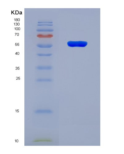 SDS-PAGE analysis of Human CRBN (Protein Cereblon) - Recombinant Protein, showing >90% purity under 15% SDS-PAGE (Reduced)