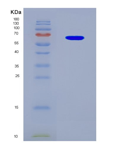 SDS-PAGE analysis of Human YTHDF2 (Yth Domain-Containing Family Protein 2) - Recombinant Protein, showing >90% purity under 15% SDS-PAGE (Reduced)