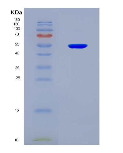 SDS-PAGE analysis of Human AKAP12 (A-Kinase Anchor Protein 12) - Recombinant Protein, showing >90% purity under 15% SDS-PAGE (Reduced)