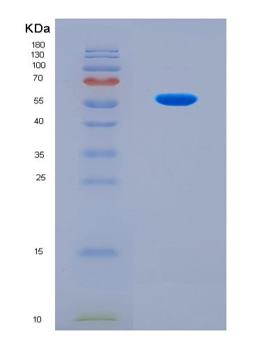 SDS-PAGE analysis of Mouse F10 (Coagulation Factor X) - Recombinant Protein, showing >90% purity under 15% SDS-PAGE (Reduced)