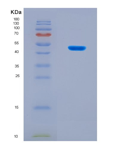 SDS-PAGE analysis of Human FST (Follistatin) - Recombinant Protein, showing >90% purity under 15% SDS-PAGE (Reduced)