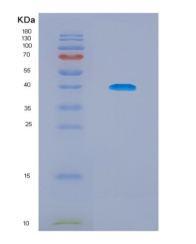 SDS-PAGE analysis of Human EPAS1 (Endothelial Pas Domain-Containing Protein 1) - Recombinant Protein, showing >95% purity under 15% SDS-PAGE (Reduced)