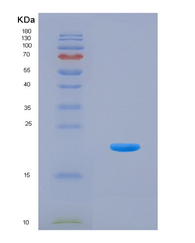 SDS-PAGE analysis of Mouse Slpi (Antileukoproteinase) - Recombinant Protein, showing >90% purity under 15% SDS-PAGE (Reduced)