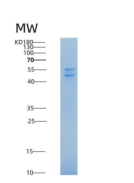 SDS-PAGE analysis of Mouse Calr (Calreticulin) - Recombinant Protein, showing >90% purity under 15% SDS-PAGE (Reduced)