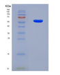 SDS-PAGE analysis of Human VDAC1 (Non-Selective Voltage-Gated Ion Channel Vdac1) - Recombinant Protein, showing >90% purity under 15% SDS-PAGE (Reduced)