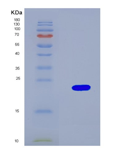SDS-PAGE analysis of Mouse Mettl3 (N(6)-Adenosine-Methyltransferase Catalytic Subunit Mettl3) - Recombinant Protein, showing >90% purity under 15% SDS-PAGE (Reduced)