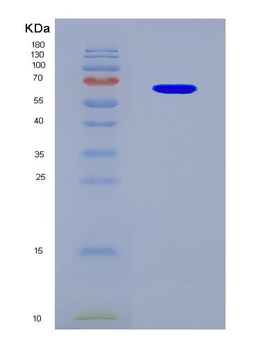 SDS-PAGE analysis of Human KMT5C (Histone-Lysine N-Methyltransferase Kmt5C) - Recombinant Protein, showing >90% purity under 15% SDS-PAGE (Reduced)
