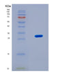 SDS-PAGE analysis of Human TOP2B (Dna Topoisomerase 2-Beta) - Recombinant Protein, showing >90% purity under 15% SDS-PAGE (Reduced)