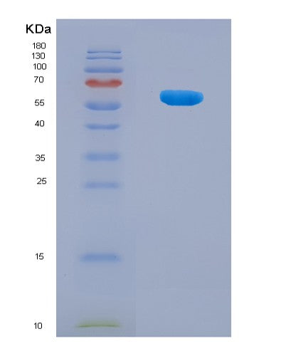 SDS-PAGE analysis of Human NDUFV1 (Nadh Dehydrogenase [Ubiquinone] Flavoprotein 1, Mitochondrial) - Recombinant Protein, showing >90% purity under 15% SDS-PAGE (Reduced)