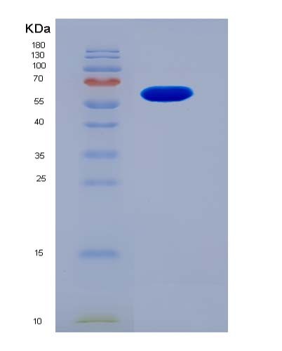 SDS-PAGE analysis of Human KIN (Dna/Rna-Binding Protein Kin17) - Recombinant Protein, showing >95% purity under 15% SDS-PAGE (Reduced)