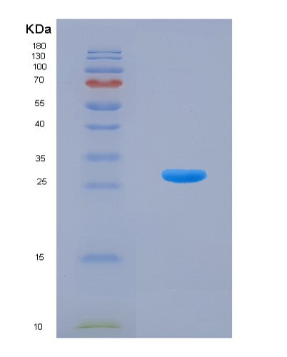 SDS-PAGE analysis of Mouse Tnfsf11 (Tumor Necrosis Factor Ligand Superfamily Member 11) - Recombinant Protein, showing >90% purity under 15% SDS-PAGE (Reduced)