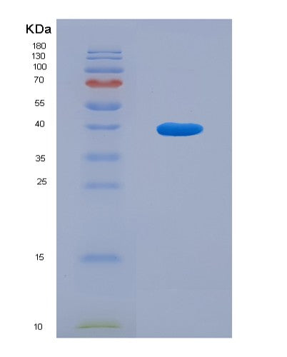 SDS-PAGE analysis of Human GOLPH3 (Golgi Phosphoprotein 3) - Recombinant Protein, showing >90% purity under 15% SDS-PAGE (Reduced)