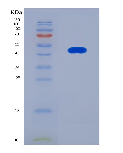 SDS-PAGE analysis of Human STOM (Stomatin) - Recombinant Protein, showing >90% purity under 15% SDS-PAGE (Reduced)
