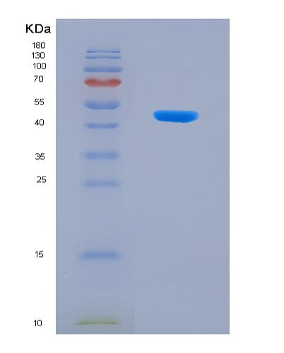 SDS-PAGE analysis of Human PDHA1 (Pyruvate Dehydrogenase E1 Component Subunit Alpha, Somatic Form, Mitochondrial) - Recombinant Protein, showing >90% purity under 15% SDS-PAGE (Reduced)