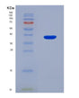SDS-PAGE analysis of Mouse Matk (Megakaryocyte-Associated Tyrosine-Protein Kinase) - Recombinant Protein, showing >90% purity under 15% SDS-PAGE (Reduced)