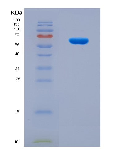 SDS-PAGE analysis of Human MACC1 (Metastasis-Associated In Colon Cancer Protein 1) - Recombinant Protein, showing >85% purity under 15% SDS-PAGE (Reduced)