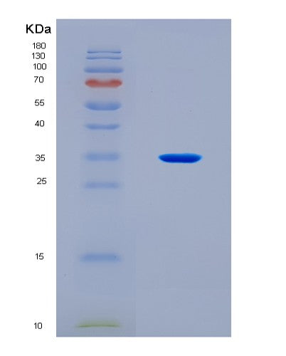 SDS-PAGE analysis of Human SYCP3 (Synaptonemal Complex Protein 3) - Recombinant Protein, showing >90% purity under 15% SDS-PAGE (Reduced)