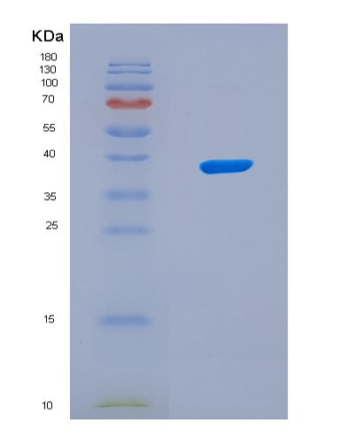 SDS-PAGE analysis of Human ITGB4 (Integrin Beta-4) - Recombinant Protein, showing >90% purity under 15% SDS-PAGE (Reduced)