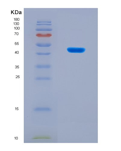 SDS-PAGE analysis of Mouse Ppara (Peroxisome Proliferator-Activated Receptor Alpha) - Recombinant Protein, showing >90% purity under 15% SDS-PAGE (Reduced)